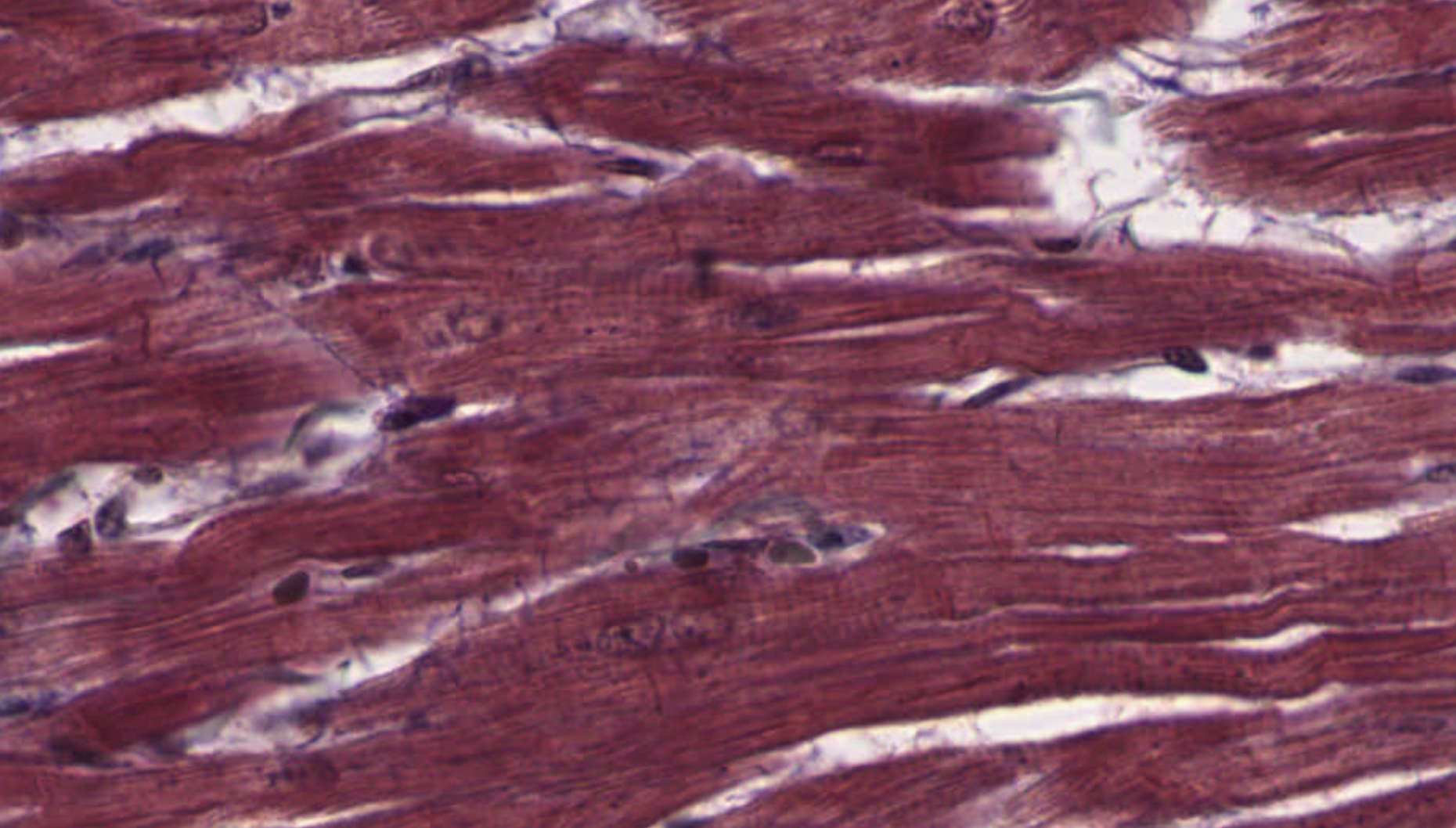 Cardiac muscle right heart wall Masson's Trichrome