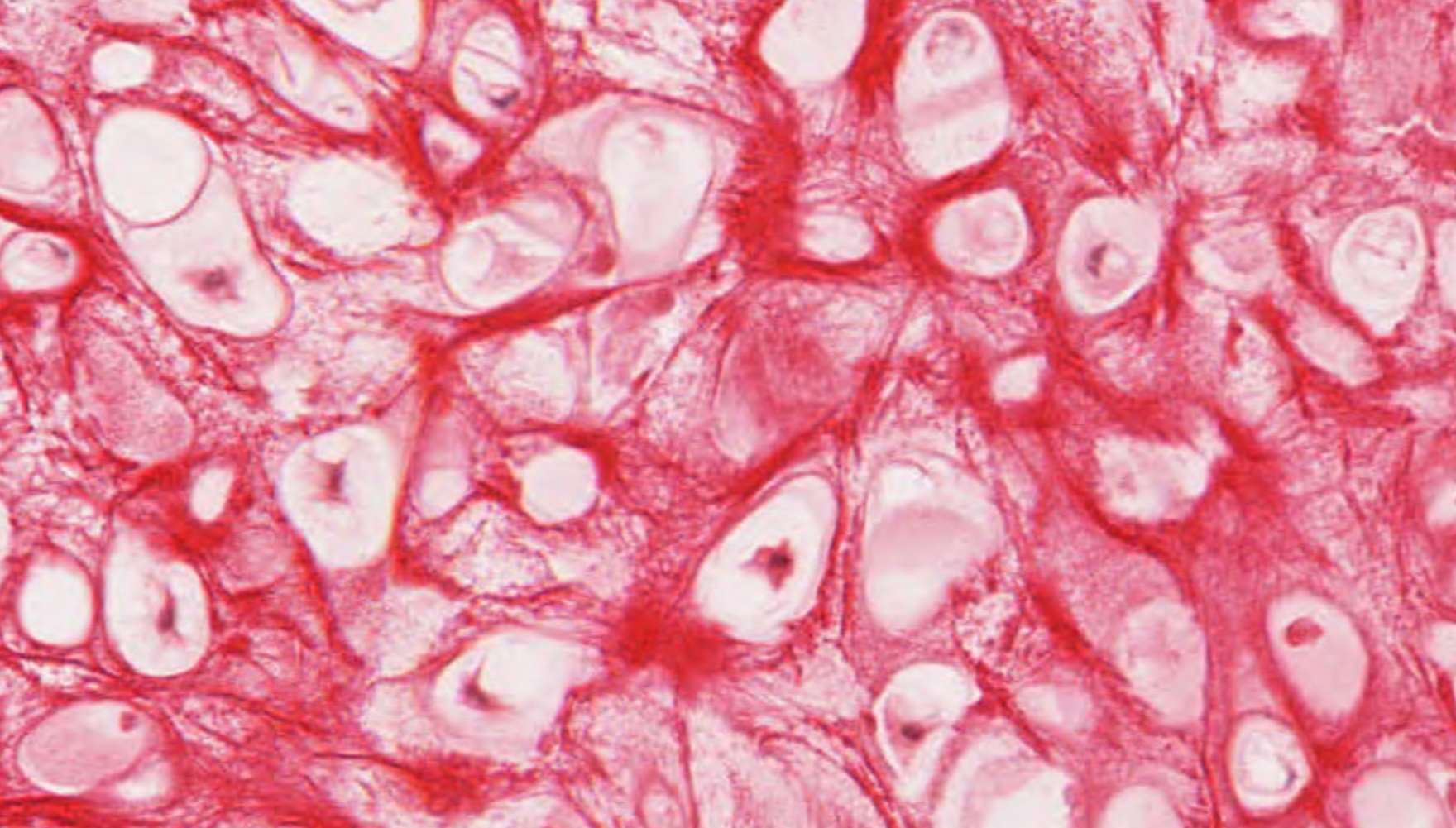 Epiglottis high magnification showing elastic cartilage and chondrocytes.