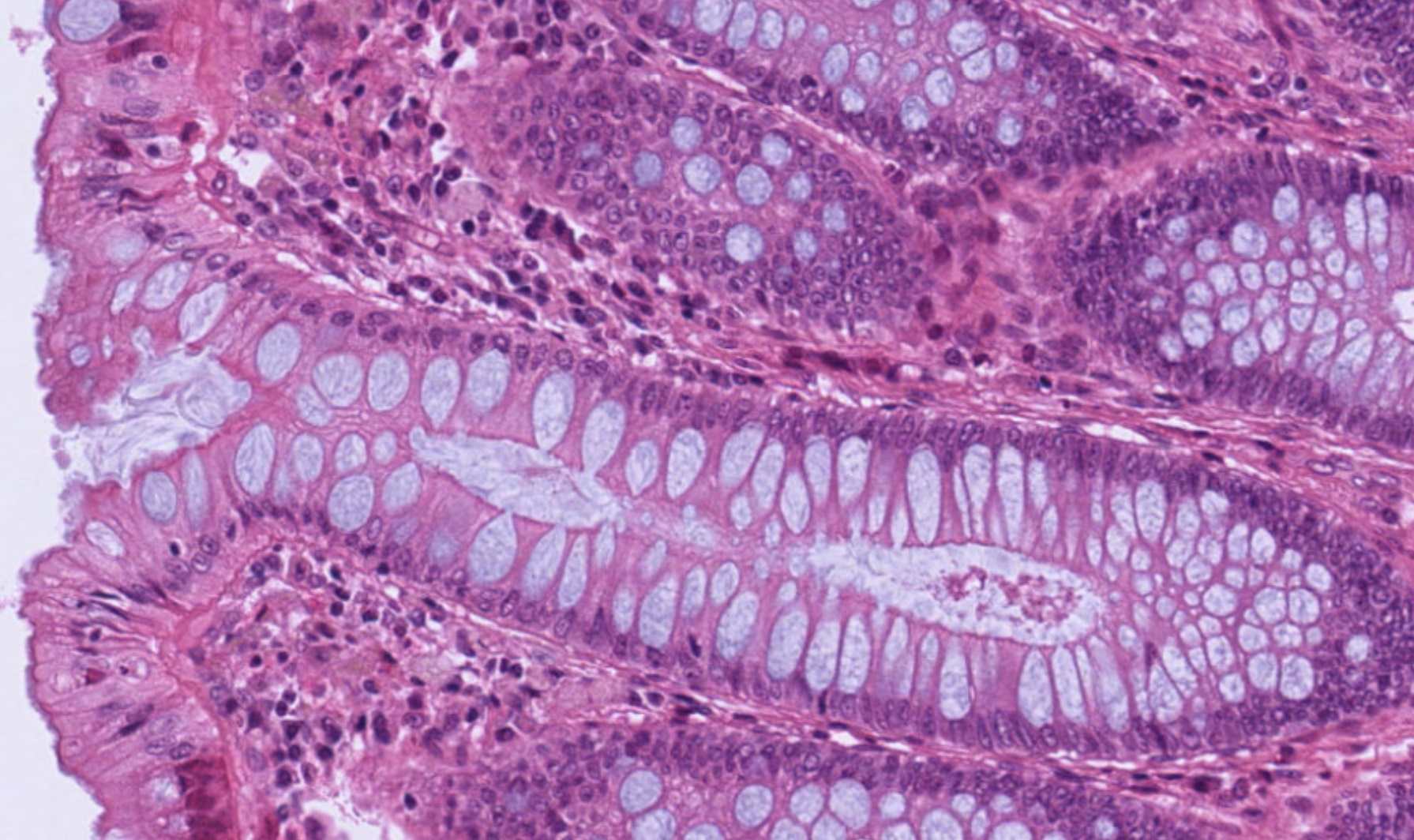Colon mucosa H&E showing flat surface, deep straight crypts, abundant goblet cells.
