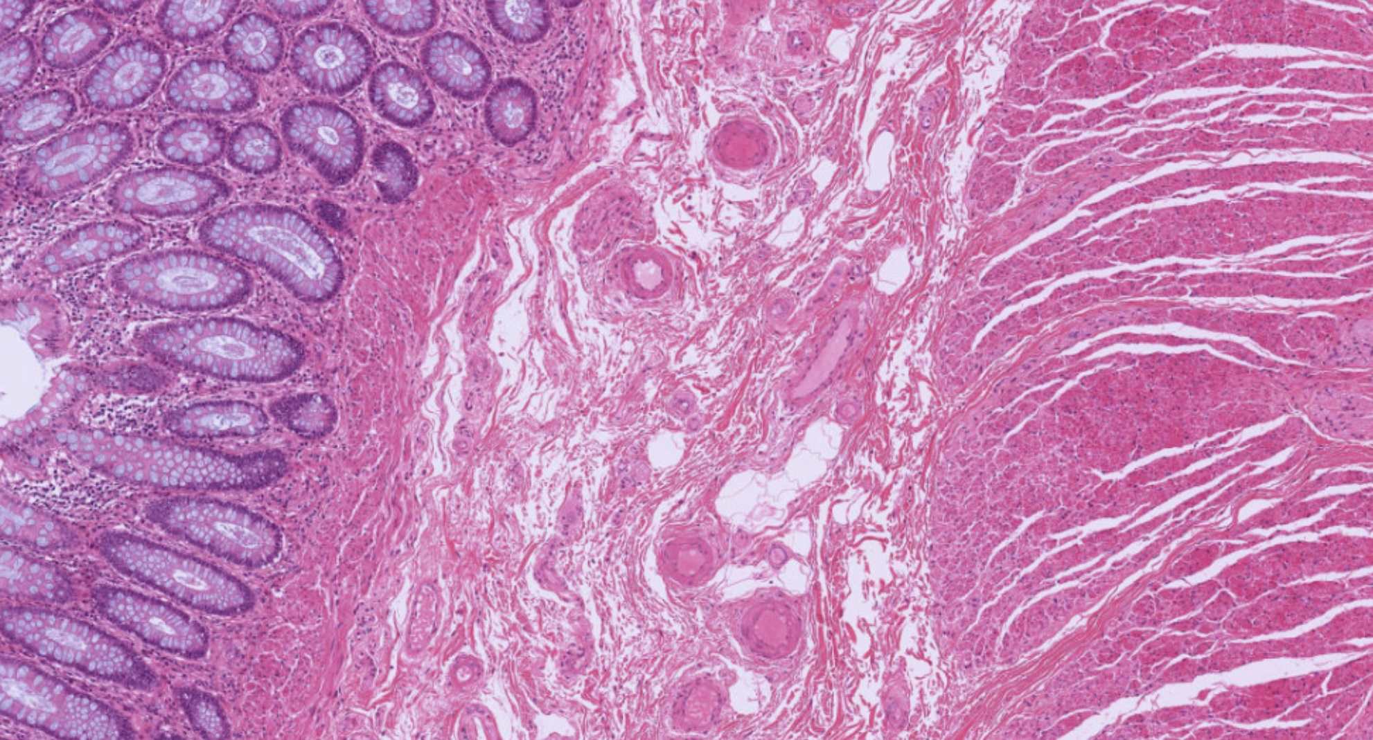 Colon submucosa H&E showing loose CT, vessels, and lymphatics.