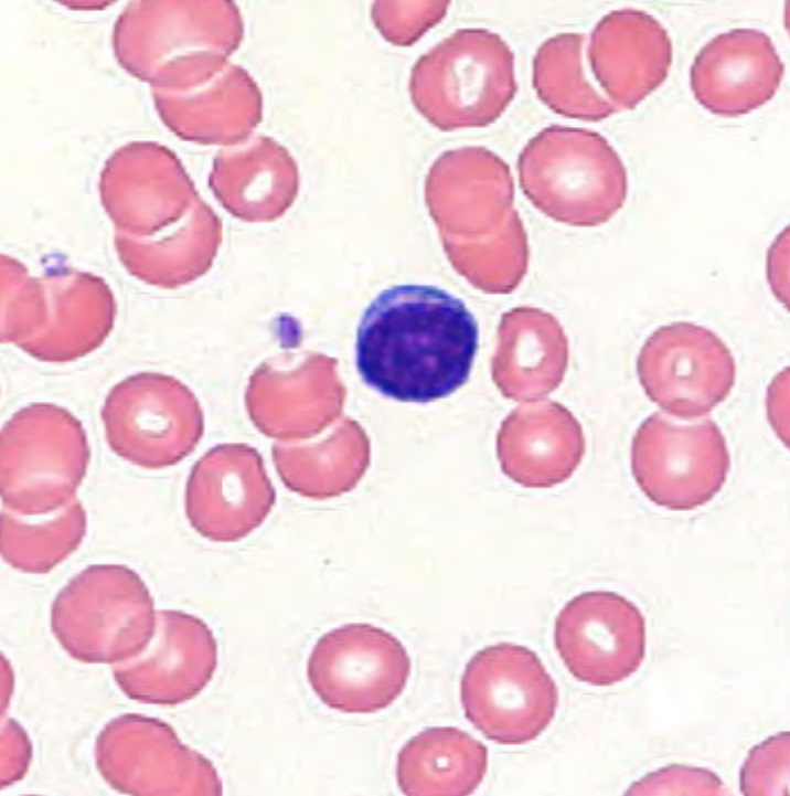 Normal Lymphocyte Most Things Biology
