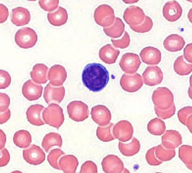 Normal Lymphocyte Most Things Biology