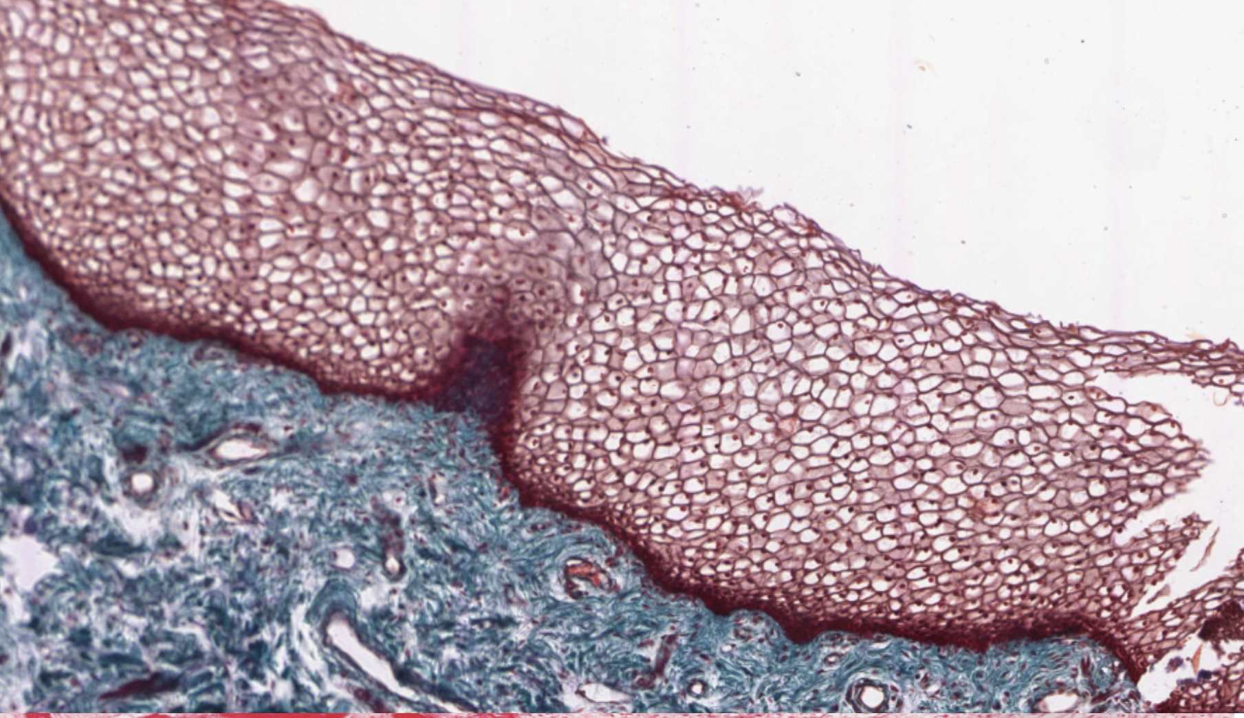 Oral mucosa H&E micrograph showing non-keratinized stratified squamous epithelium.