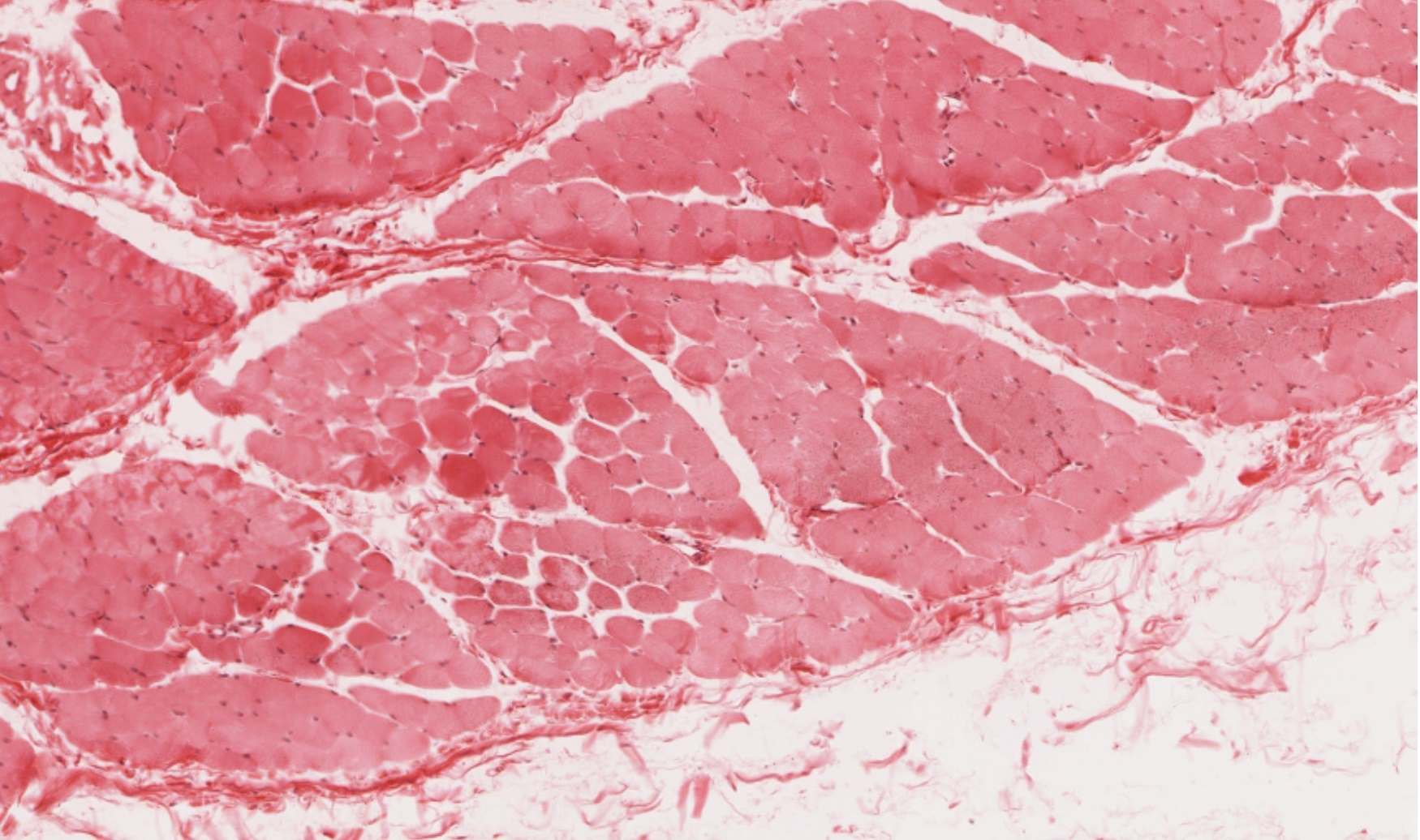 Skeletal muscle cross section H&E