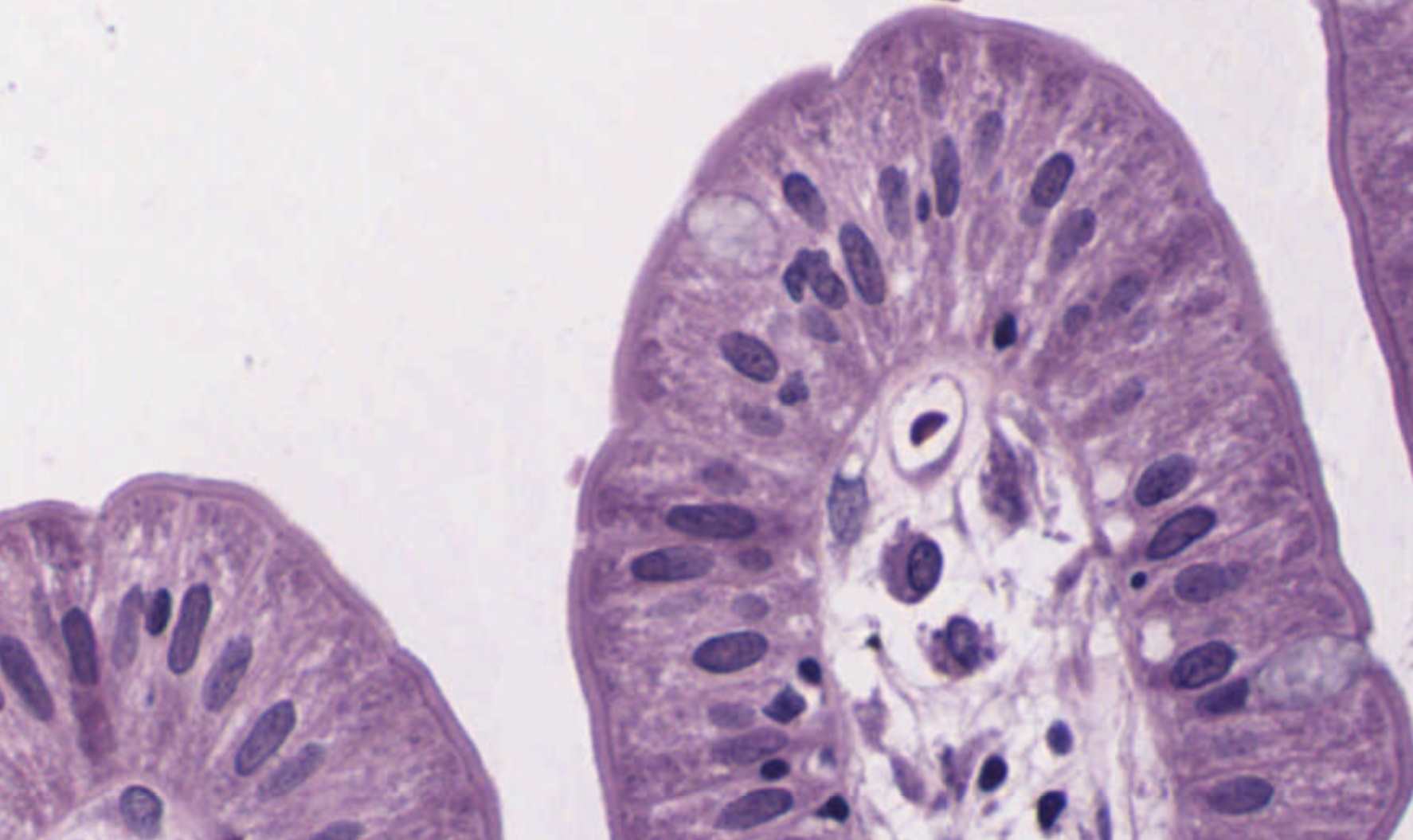 Jejunum cross-section, second view.