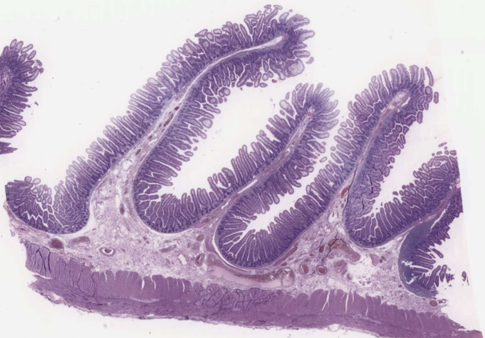 Jejunum cross-section showing plicae circulares and villi.