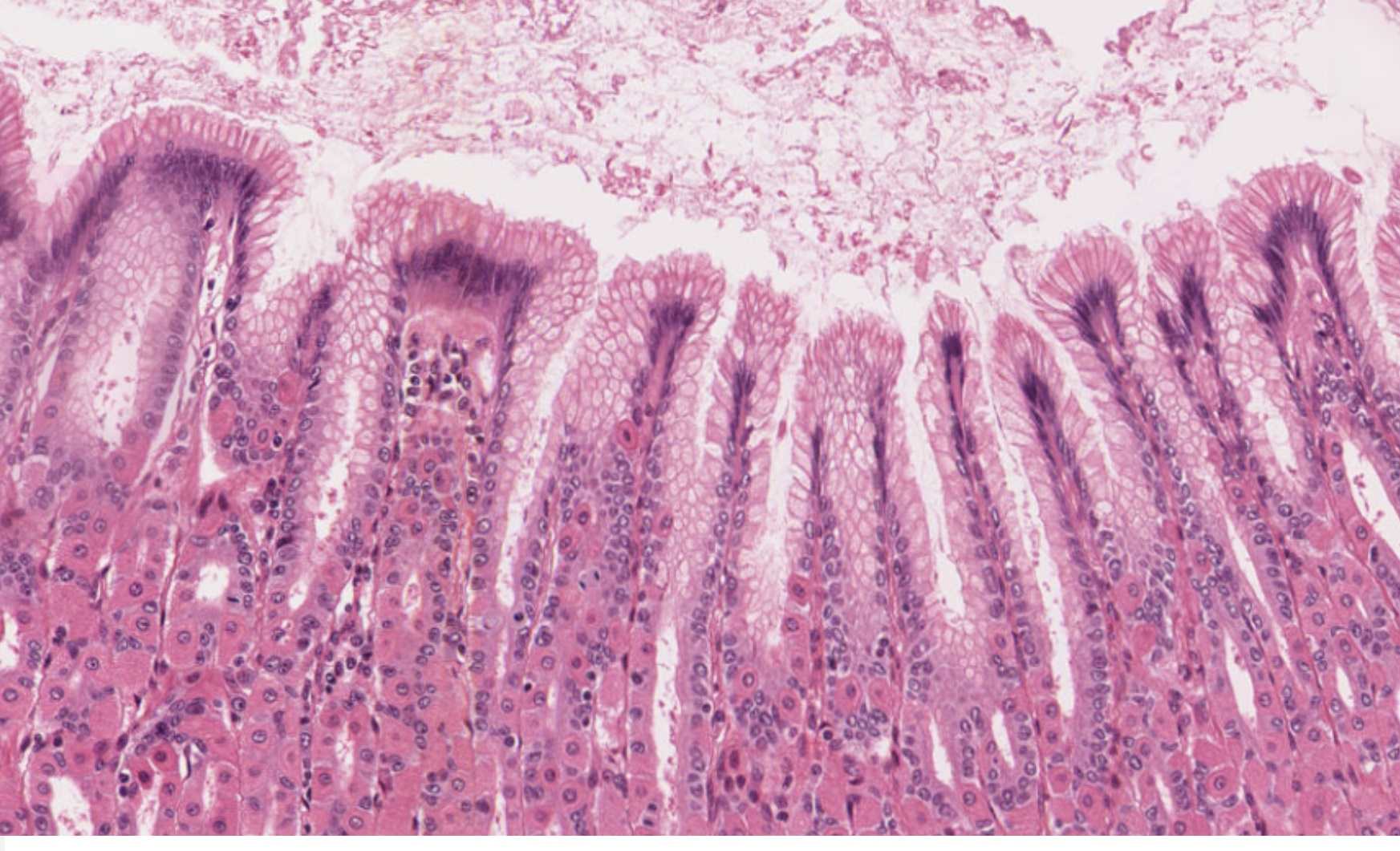 Stomach mucosa H&E micrograph showing pits, glands, parietal and chief cells.