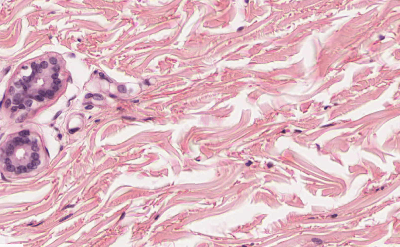 Dense Regular CT H&E Slide 104