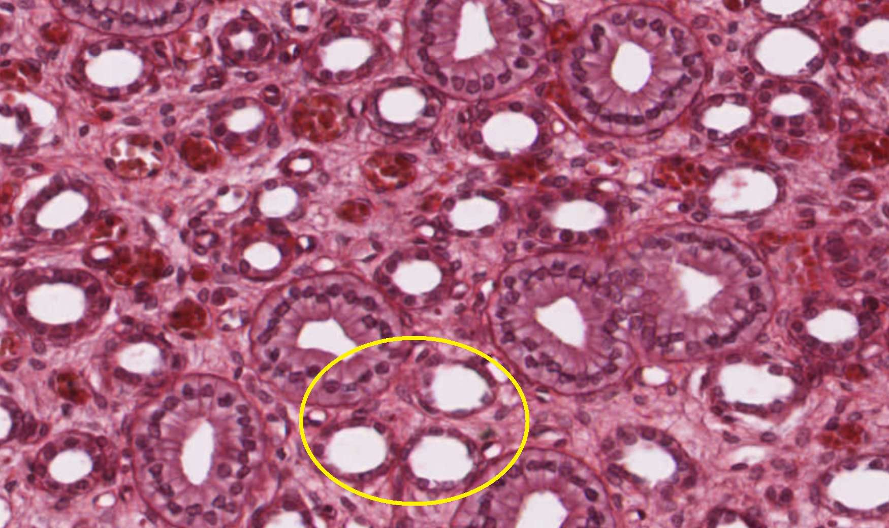 Kidney medulla micrograph showing labeled nephron loop.