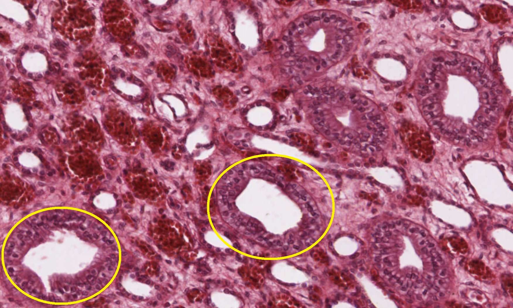Renal medulla, slide #206, labeled collecting ducts.