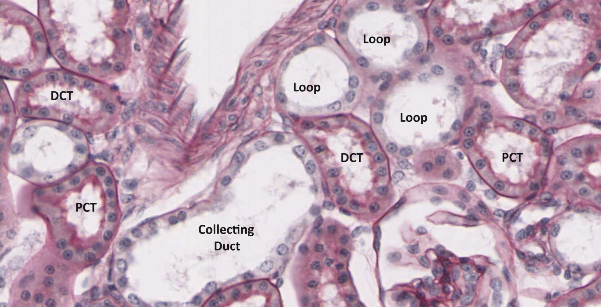 Kidney micrograph, PAS stain, with PCT brush borders highlighted.
