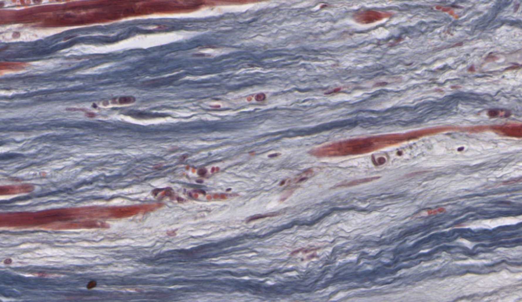 Fibrous Skeleton Dense Irregular CT Masson's Trichrome Slide 100