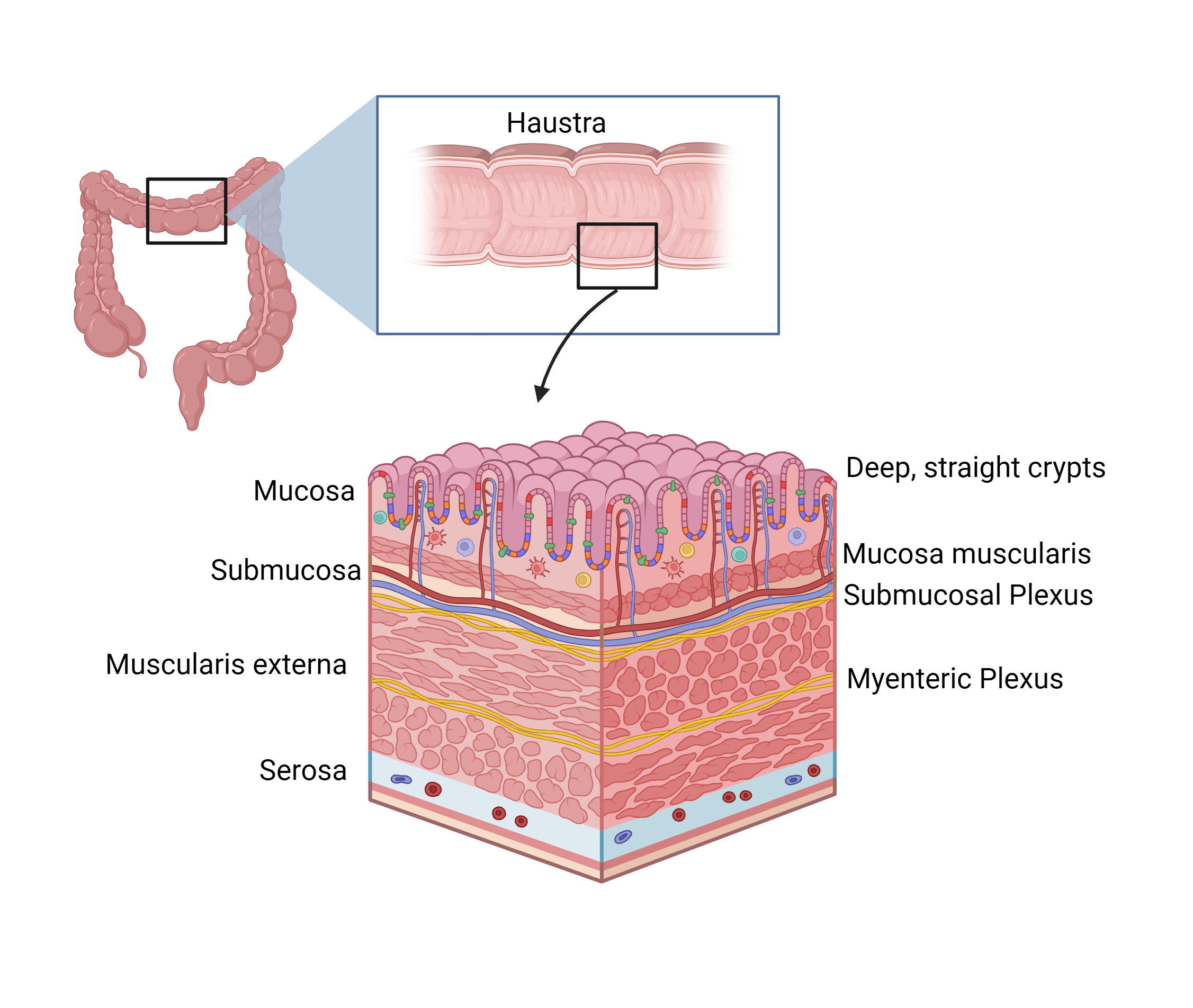 Large intestine accessory image — colon, rectum, anus reference.