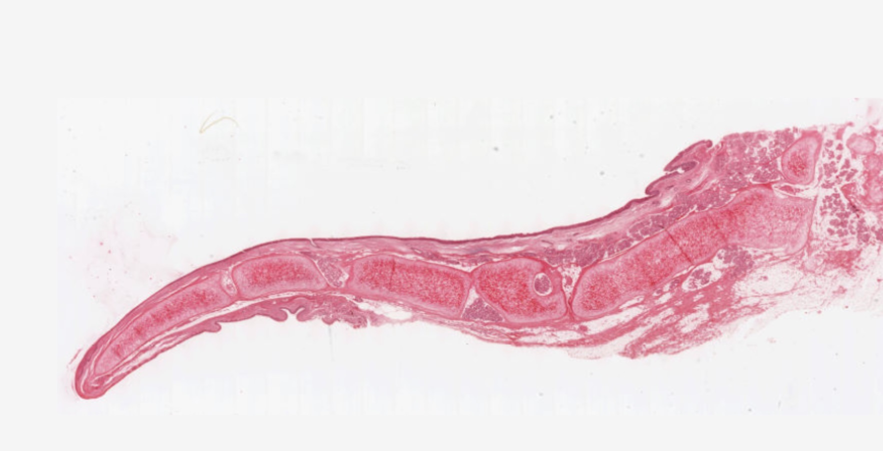 Epiglottis low magnification showing whole leaf shape, elastic cartilage core, and surface epithelium.
