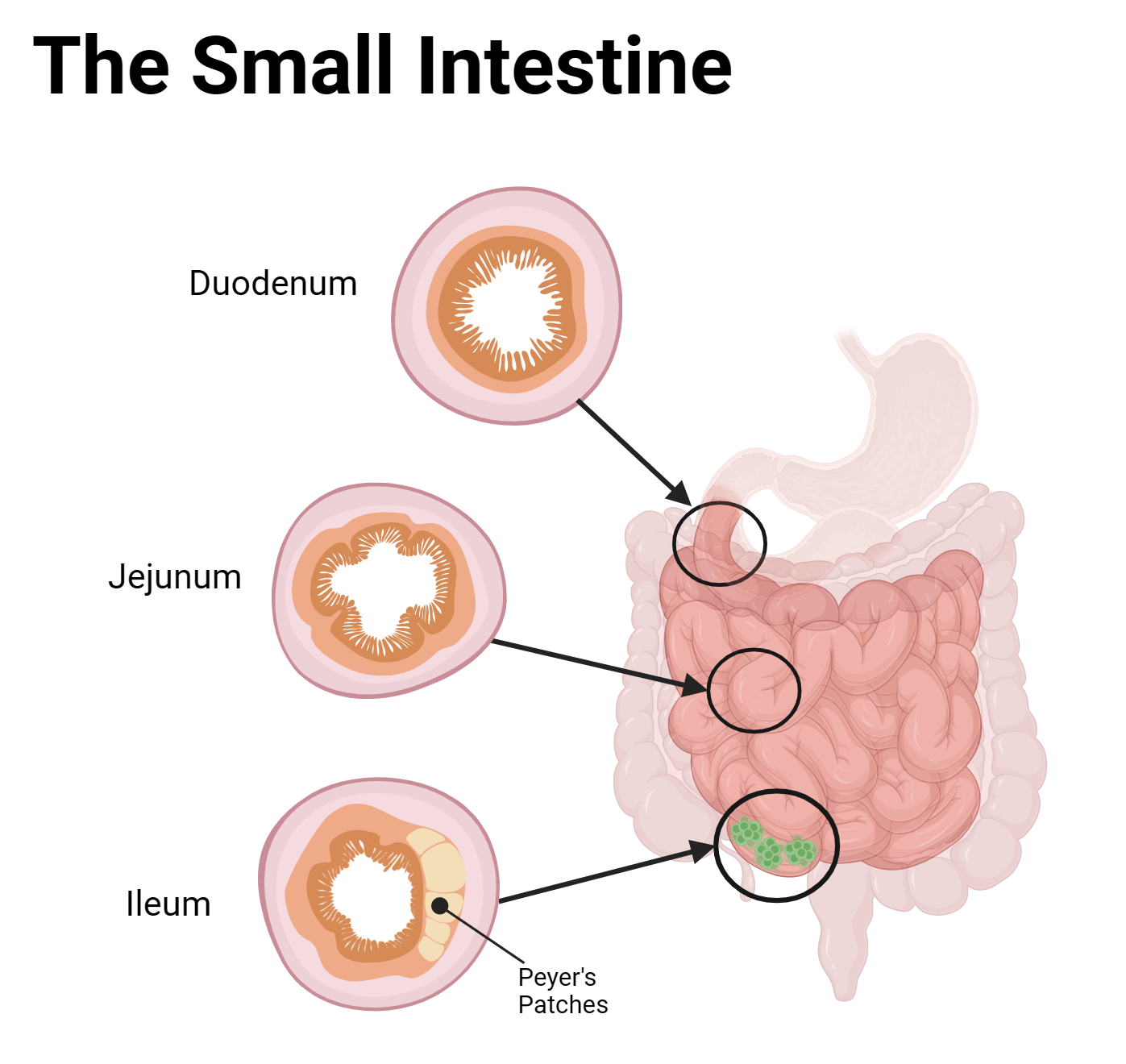 Comparison of duodenum, jejunum, and ileum showing diagnostic features.